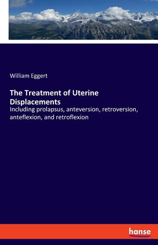 The Treatment of Uterine Displacements: Including prolapsus, anteversion, retroversion, anteflexion, and retroflexion - pzsku/Z0D71E38ADE2E0A454128Z/45/1749035503/ef906146-2df7-4fee-ab54-63e0ab00ad38