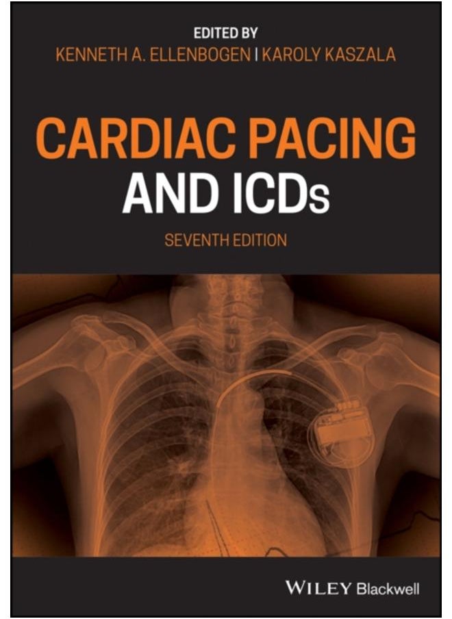 Cardiac Pacing and ICDs 