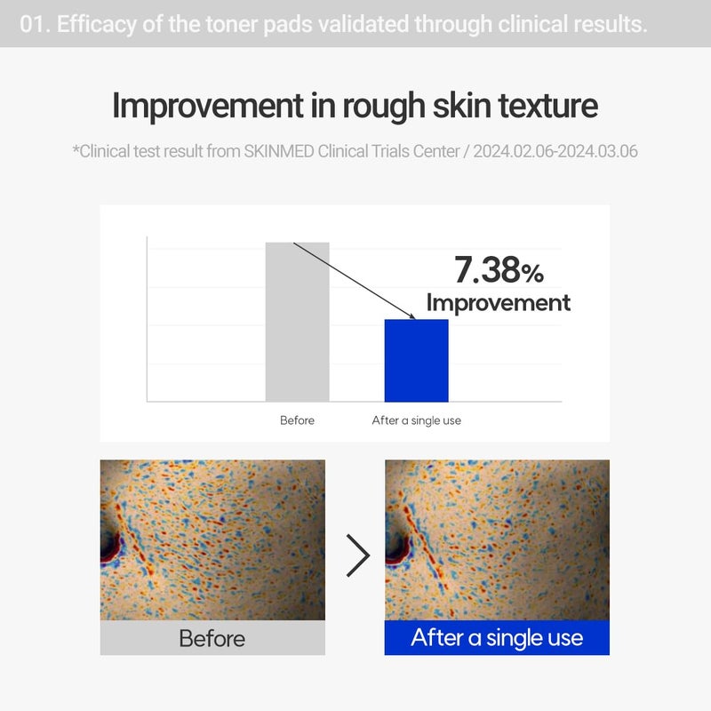 ROVECTIN Pore Care No-Sebum Pad for Sebum Clearing and Pore Clearing with Green Fruit Complex, Gentle Exfoliating Pads - 60 Pads - Image 5