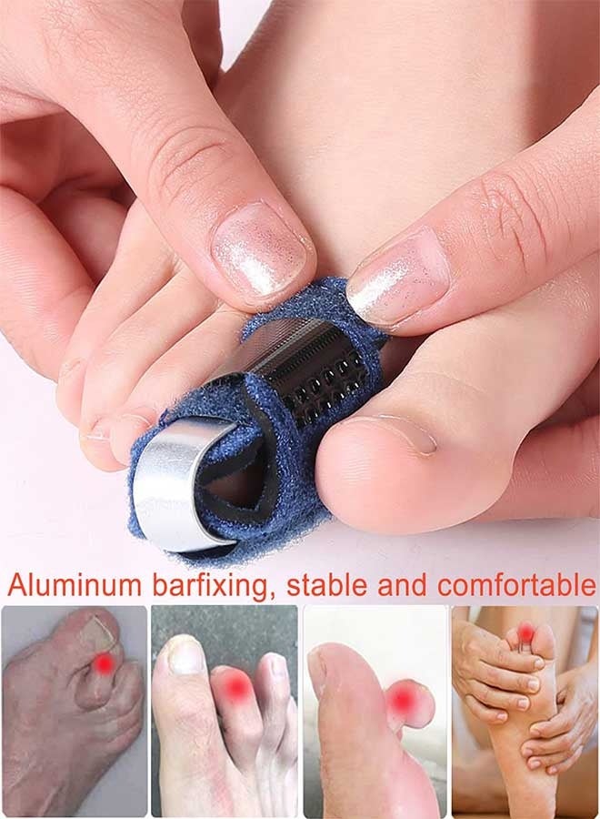RAWAID 1 Pair Toe Splint Broken Toe Brace Toe Straightener for Hammer Toe, Curled Toe, Big Toe, Women Men Broken Toe Support Toe Wraps - Image 3