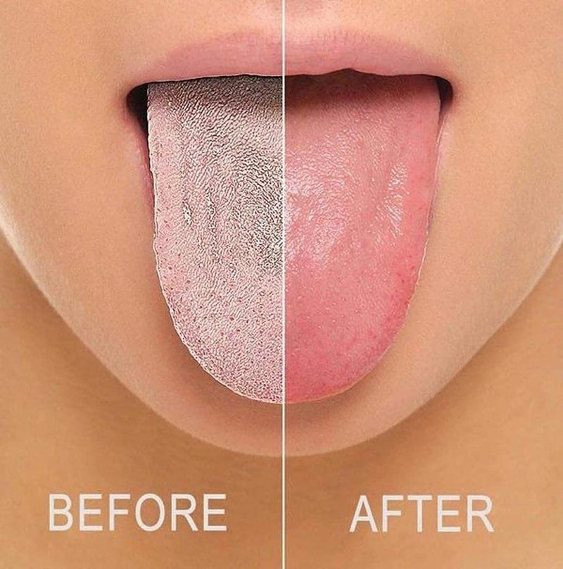 Elecsera Soft Double Action Tongue Cleaner Scrapper For Kids and Adults With Travel Capsule Plastic Tooth brush paste holder flexible design for health, Oral care tool Easy To use 5pcs - Image 2