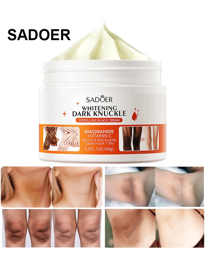 SADOER Dark Knuckle Whitening Cream, Skin Body For Dark Knees And Elbows, Moisturizing Joint Whitening Cream With Niacinamide Vitamin C, Lighten And Repair Melanin, Dark Spot Corrector Remover - Image 1