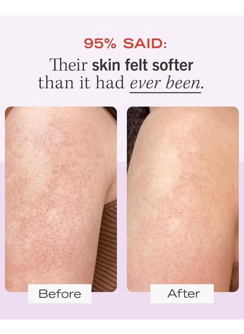 فيرست إيد بيوتي الإسعافات الأولية الجمال KP صدمة مسح الجسم مع 10٪ AHA 226g - Image 2