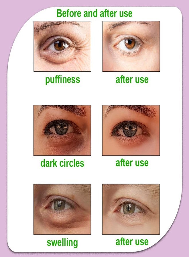 CONBELLA وسادات عيون كونبيلا الساخنة والباردة، لاصقات عيون قابلة لإعادة الاستخدام - مهدئة، متجددة، تقليل الانتفاخ، انتعاش، تخفيف التوتر، استرخاء، تخفيف الانتفاخ والتوتر (2 بطيخ + 2 خيار) - Image 4