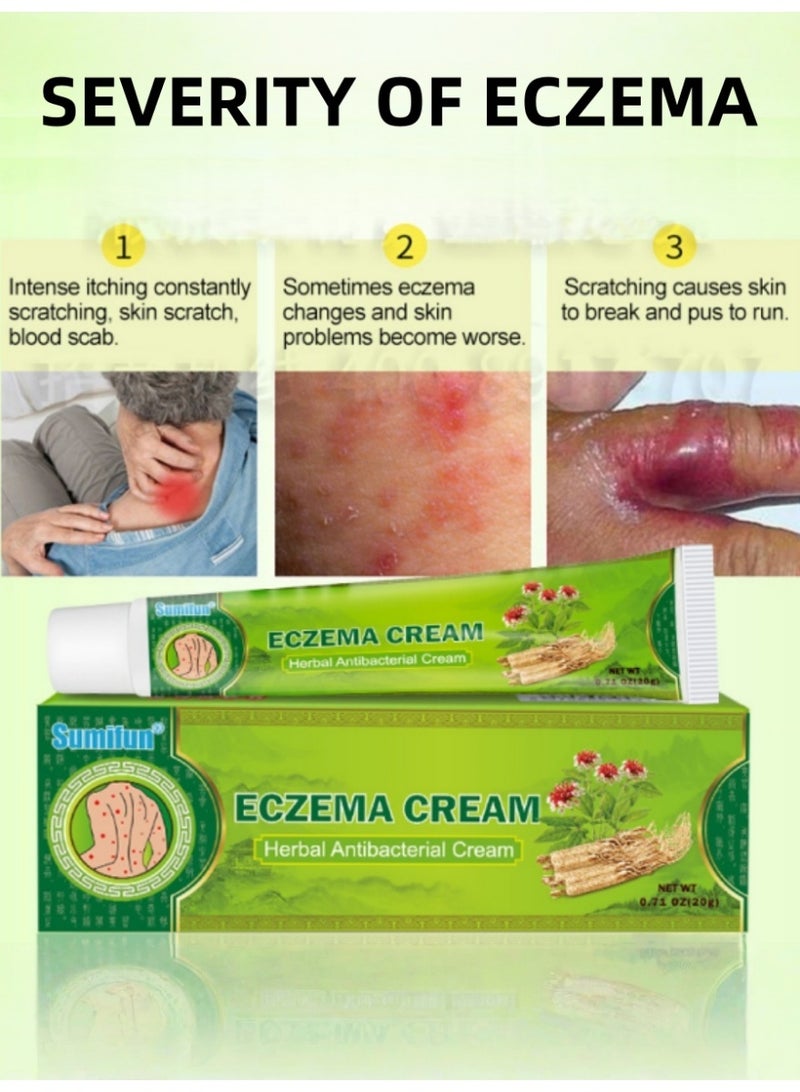 سوميفون كريم طبيعي بالأعشاب للإكزيما والصدفية 20 جرام لتخفيف الحكة السريع وتقليل احمرار الجلد - Image 4