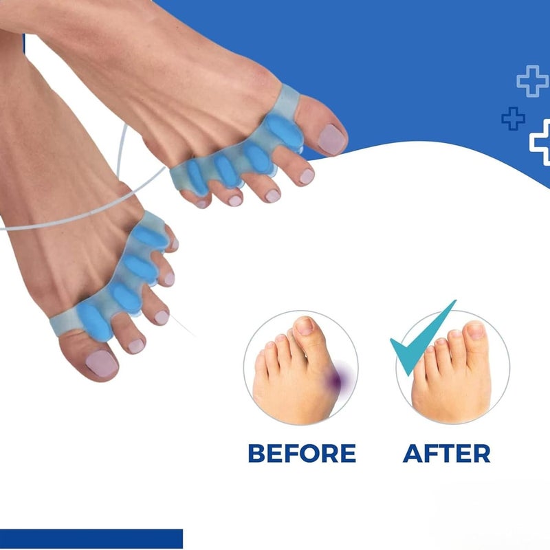 SEFLICA Toe Bunion Corrector Toe Separators For Feet | 5 Holes Silicon High Elastic Toe Straightener | Hammer Hallux Valgus Corrector Pain Relief | Achilles Stretcher - Blue (One Size) (Blue) - Image 3
