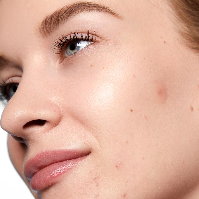 PEACE OUT Acne Day Dot, Sheer Acne Healing Dots, Virtually Invisible Wear, Hydrocolloid Pimple Patches Helps Clear Blemishes Quickly with Encapsulated Salicylic Acid, Retinol & Aloe Vera, 20 dots - Image 4