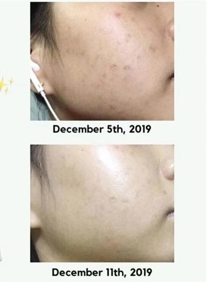 AXIS-Y 2pcs Access Way Dark Spot Correcting Serum 50ml - Image 2