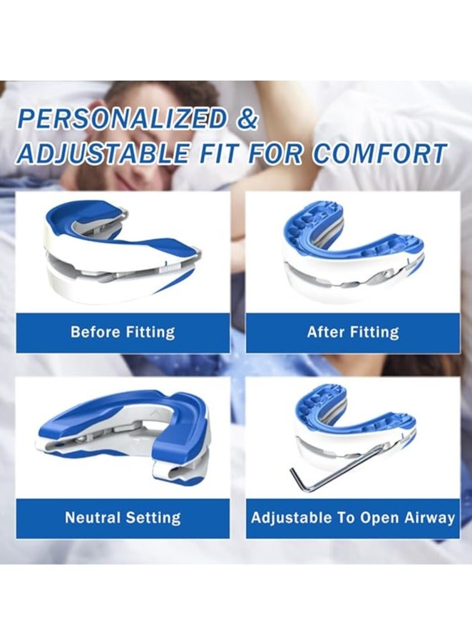 general Oral anti-snoring device, silicone creative anti-snoring device, sports mouthguard, orthodontic, anti-snoring, anti-snoring braces - Image 3