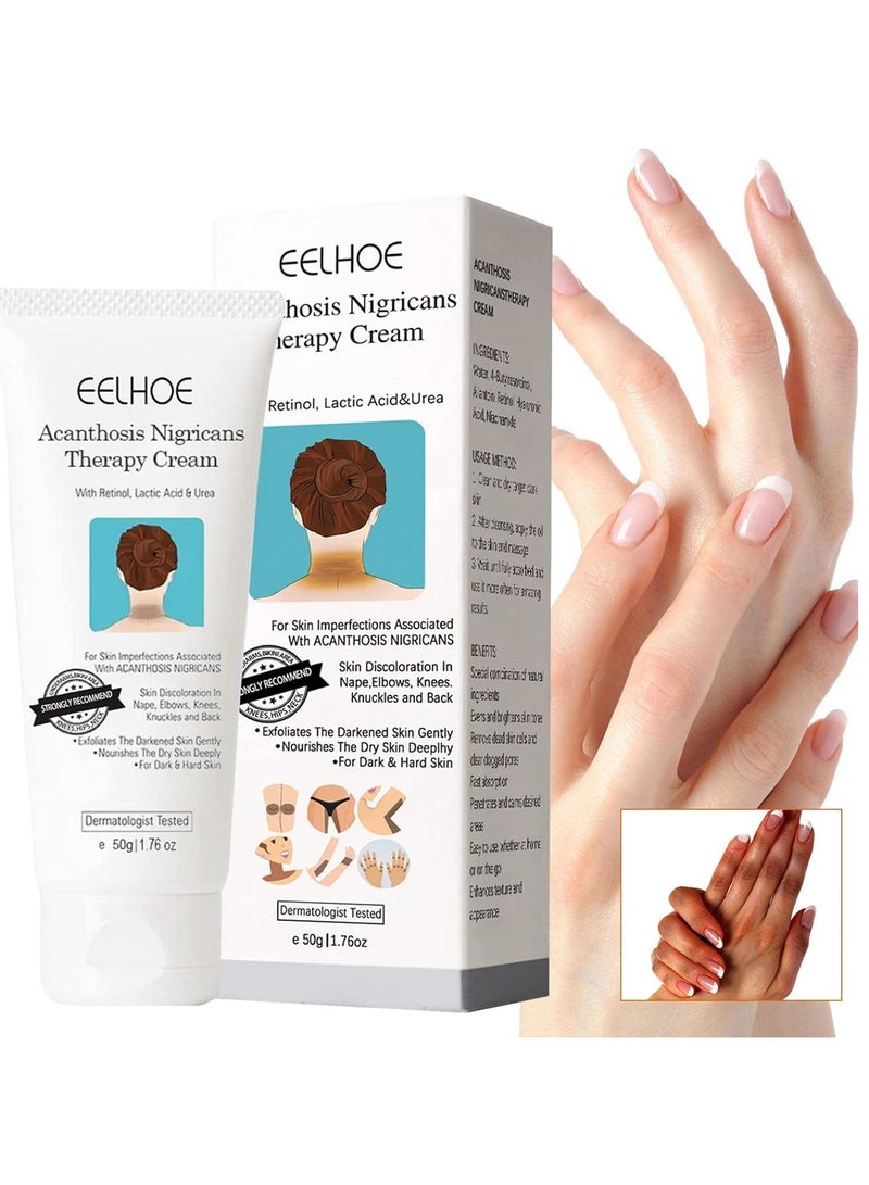 EELHOE Body Whitening Cream, Exfoliating Lotion for Lightening Skin Tone, Dark Knuckles, Underarms, Elbow, Knee, Legs, Nourishing - Image 1