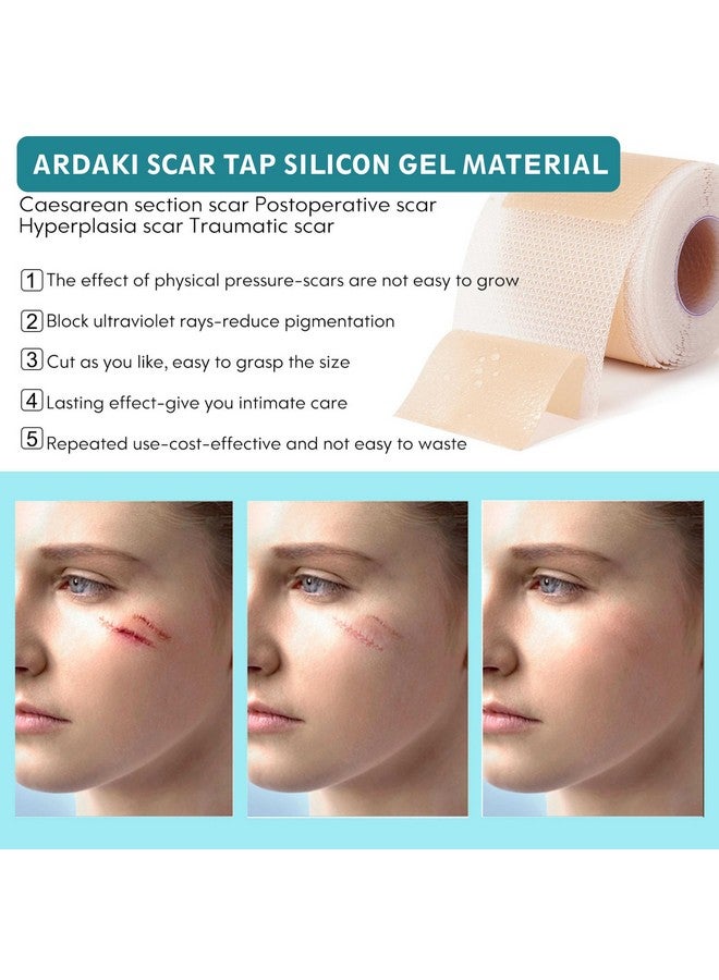 ARDAKI Silicone Scar Sheets,Silicone Scar Tape,Scar Tape For Surgical Scars,Silicone Scar Removal Strips For Surgical,C-Section,Tummy Tuck,Keloid Scars,Acne Scars, Reusable (1.6"X 60" Roll-1.5M) - Image 3