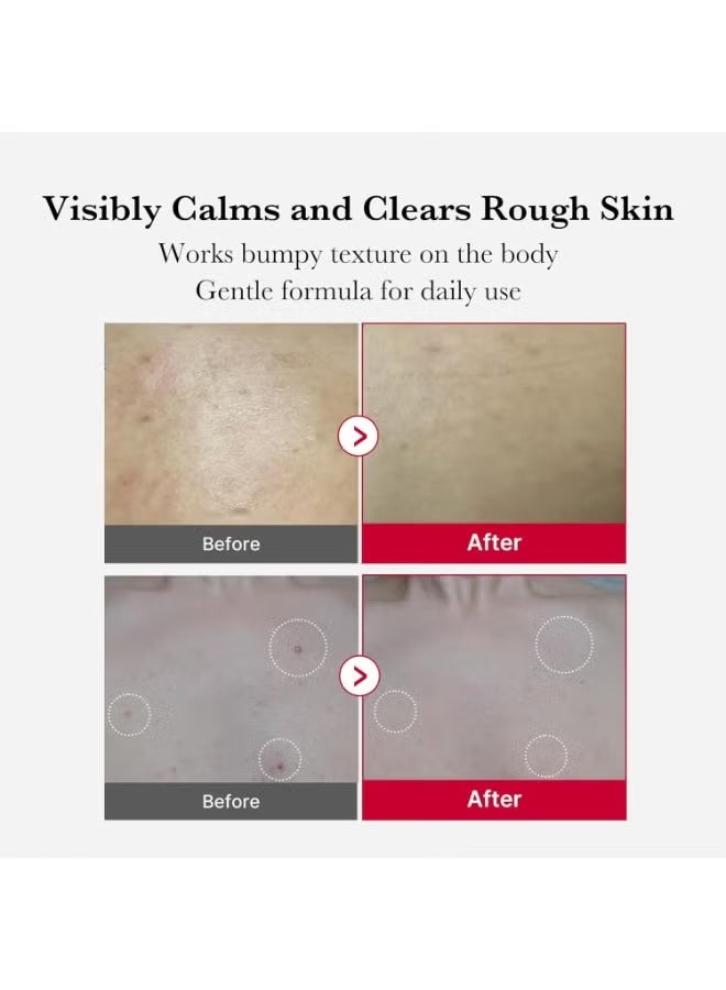 ميديكيوب جرعة تقشير الجسم الحمراء، جرعة تقشير الجسم الحمراء، بخاخ تقشير الجسم الأحمر لحب الشباب، منظف بخاخ الجسم للبشرة بالفراولة، AHA + BHA + PHA + LHA 32%، تقشير 110 جم - Image 4