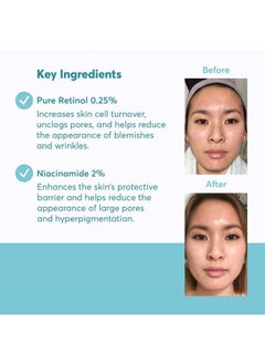 Retinol 0.25% And Niacinamide 2% Cream Reduces Blemishes And Improves Skin Texture Without Irritation - pzsku/Z0DED565C707118AD6433Z/45/_/1686397341/41226cc8-b950-4e4c-8a72-c098d3d98652