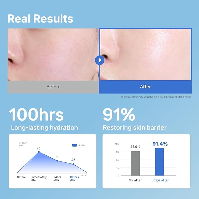 Illiyoon ILLIYOON Ceramide Ato Concentrate Cream 200ml 676 Fl Oz Moisturizer for DrySensitive Skin 100hr Hydration Restoring Skin Barrier Gentle for Infants and Adults Vegan Fragrance Free - Image 5