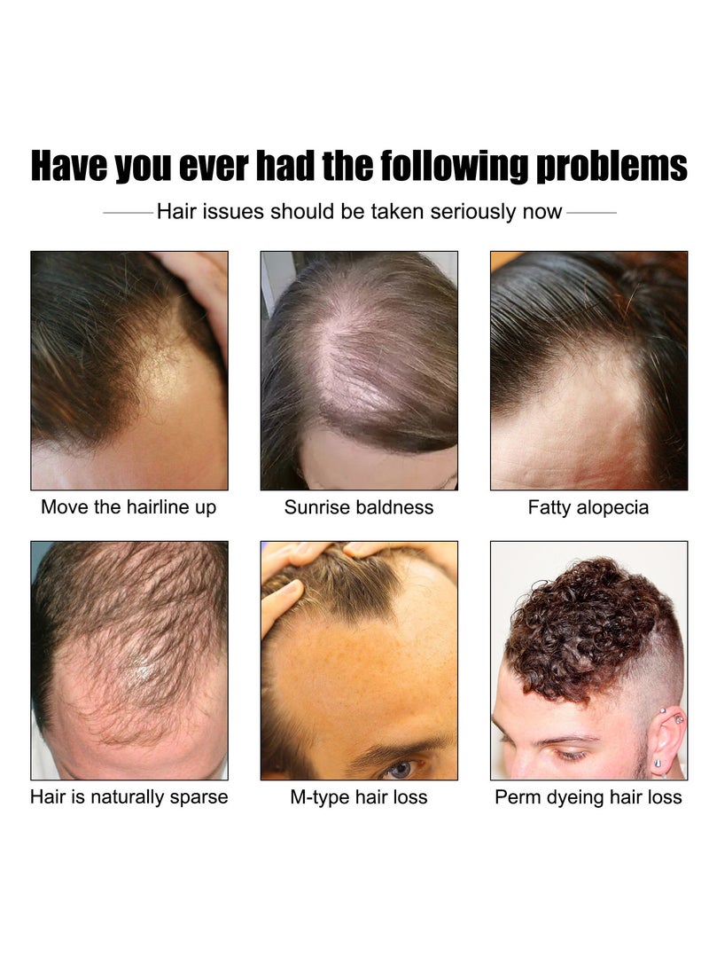 East Moon - Men's Thick Hair Serum, Hair Growth Serum For Thinning Hair For Men, Anti Hair Loss Regrowth Essence Oil For Moisturizing, Anti-hair Loss, Thick And Solid Hair - Image 1