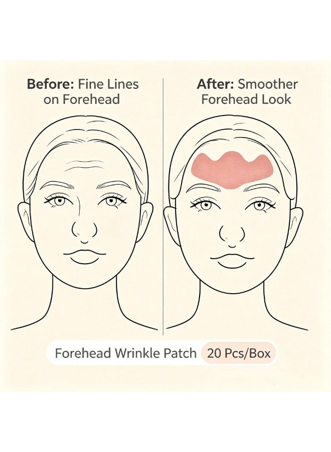 20Pcs Elastic Forehead Wrinkle Lift Tape, Anti-Aging Facial Patches, Waterproof & Breathable Skin Tightening Strips - Image 3