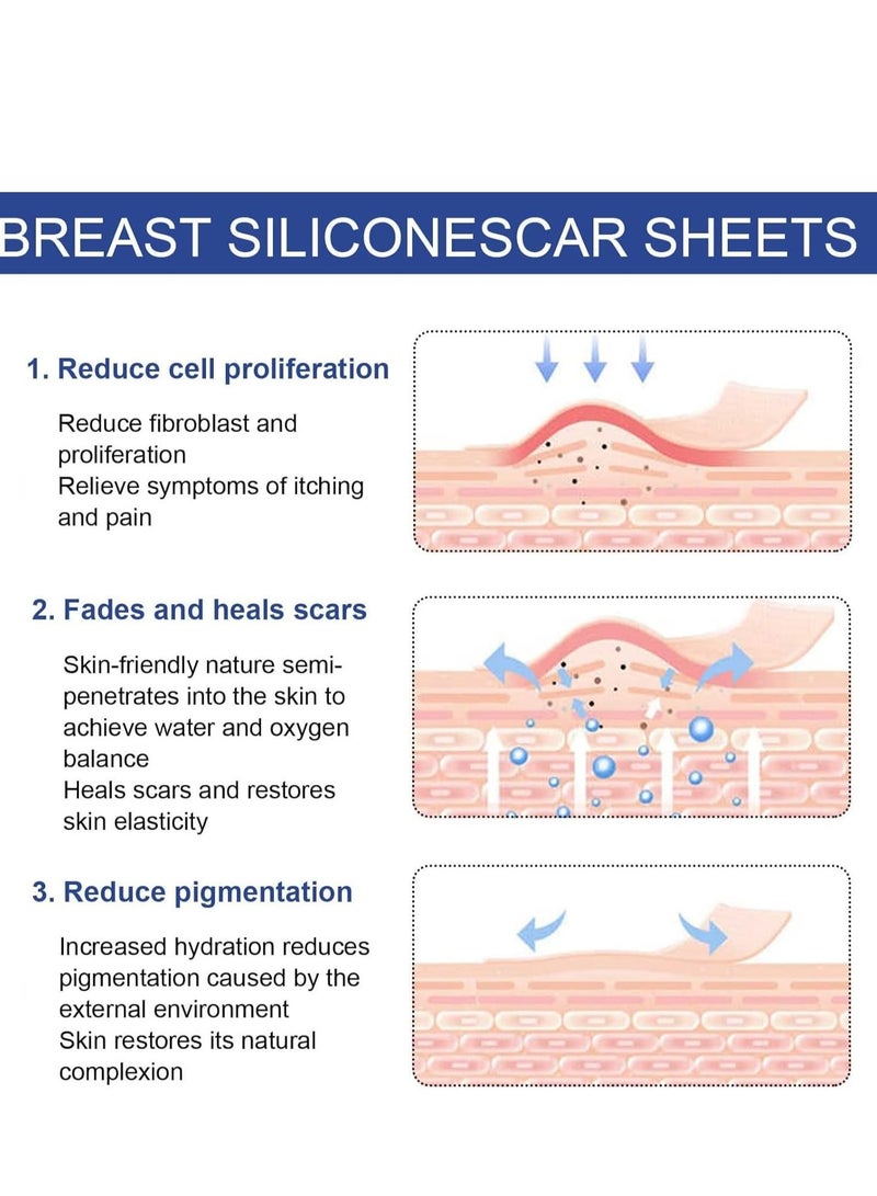 EELHOE BREAST Silicone Scar Sheets, Reusable Washable Silicone Scar Tape, Surgery Scars Removal Treatment, Medical Grade Silicone Scar Sheets for Breast - Image 4
