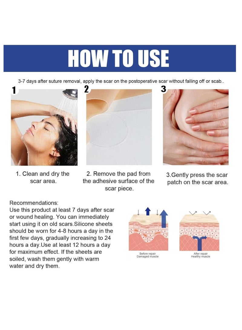 EELHOE BREAST Silicone Scar Sheets, Reusable Washable Silicone Scar Tape, Surgery Scars Removal Treatment, Medical Grade Silicone Scar Sheets for Breast - Image 3