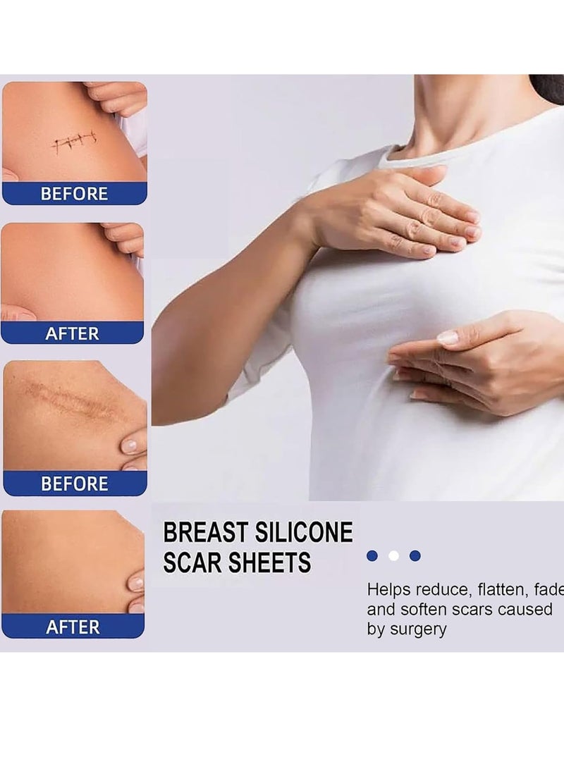EELHOE BREAST Silicone Scar Sheets, Reusable Washable Silicone Scar Tape, Surgery Scars Removal Treatment, Medical Grade Silicone Scar Sheets for Breast - Image 2