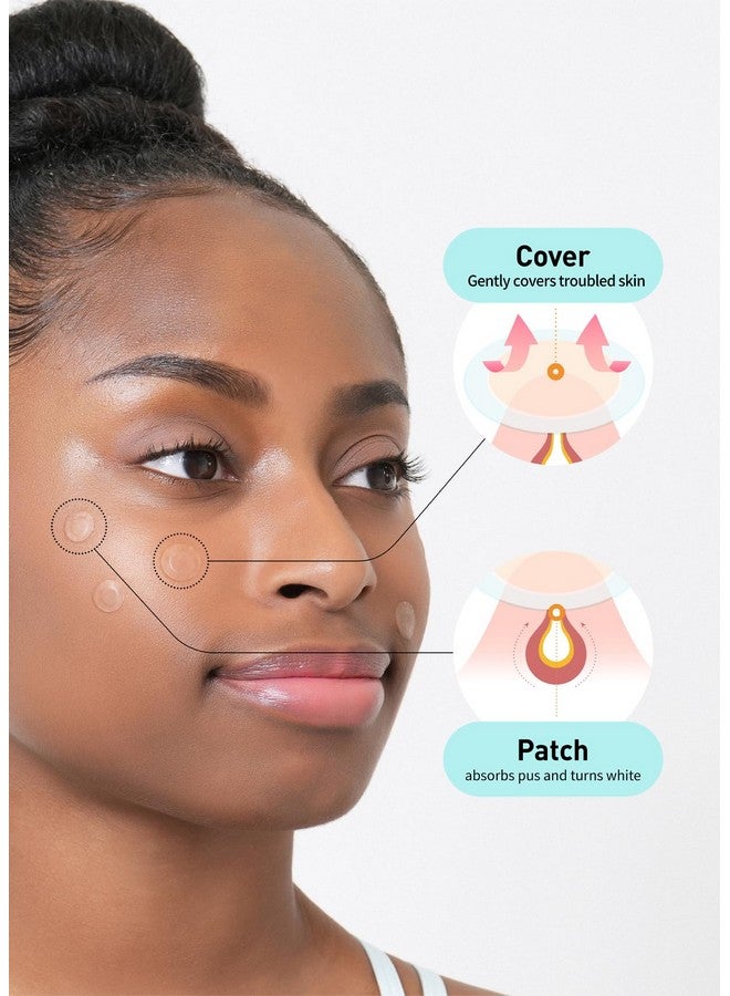 OLIVE YOUNG Care Plus Spot Patch 2 Pack Hydrocolloid Acne Korean Spot Patch To Cover Zits Pimples And Blemishes For Troubled Skin And Face (204 Count 10Mm*144Ea + 12Mm*60Ea) - Image 3