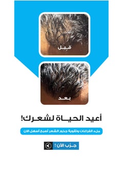 CHEVEU SOLUTIONS Cheveu Complex™ Hair Growth Kit for Men | 90-Day Supply with 5% AQUAXYL™  - Image 2