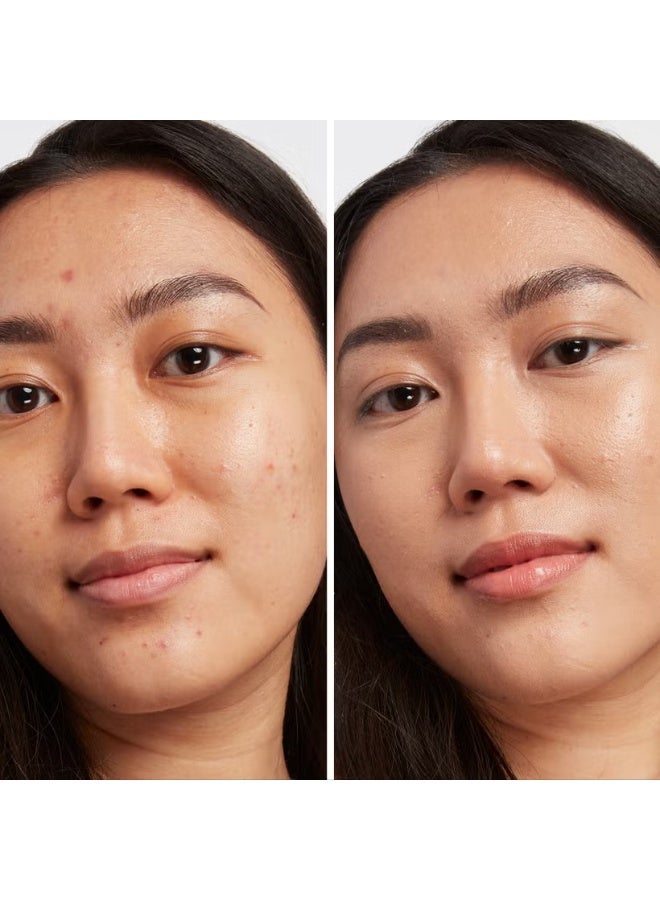 آي كوزمتيكس خافي عيوب البقع الداكنة من آي تي ​​كوزماتيكس - متوسط ​​محايد 31 - Image 2