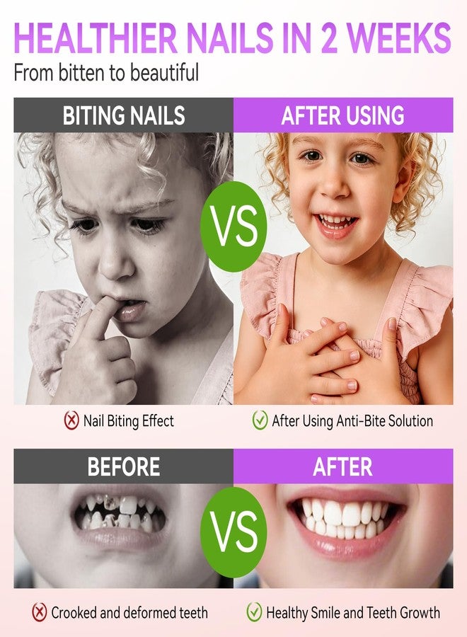 Gelike ec Stop Kids Nail Biting: Strong Extra Bitter Polish for Children - Safe Non Toxic Japanese Vegan Organic Formula to Stop Nail Biting & Thumb Sucking - Long Lasting Clear Treatment - Image 2