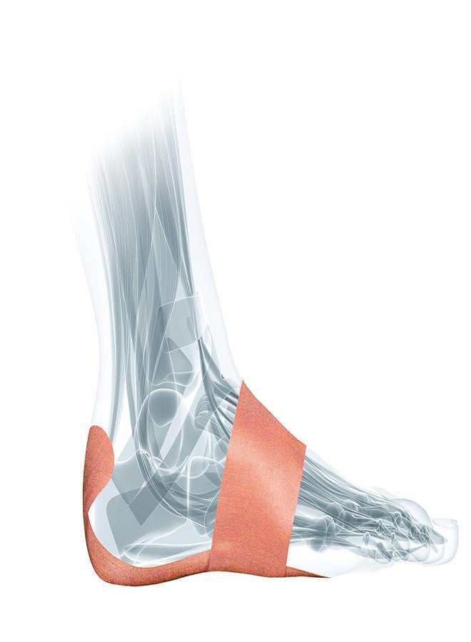 MUELLER PF TAPE SYSTEM FOR PLANTAR FASCITIS:26337 - Image 5
