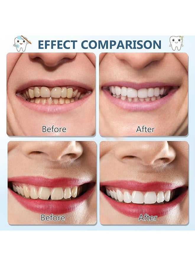 APPTRIN Teeth Veneers White Dentures for Upper and Lower for Women Men Comfortable Flex Cosmetic Teeth Comfortable and No Pain Regain Confident Smile - Image 5