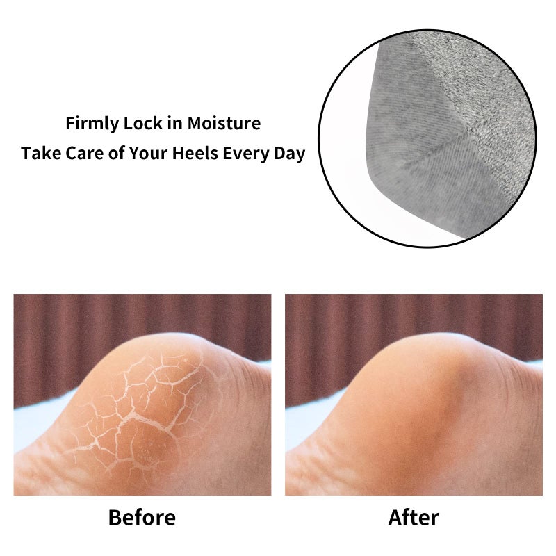 tifanso 3 Pairs Moisturizing Heel Socks for Dry Cracked Feet, Gel Repair Moisture Spa Socks for Women Dry Cracked Heels Overnight (Regular) - Image 5