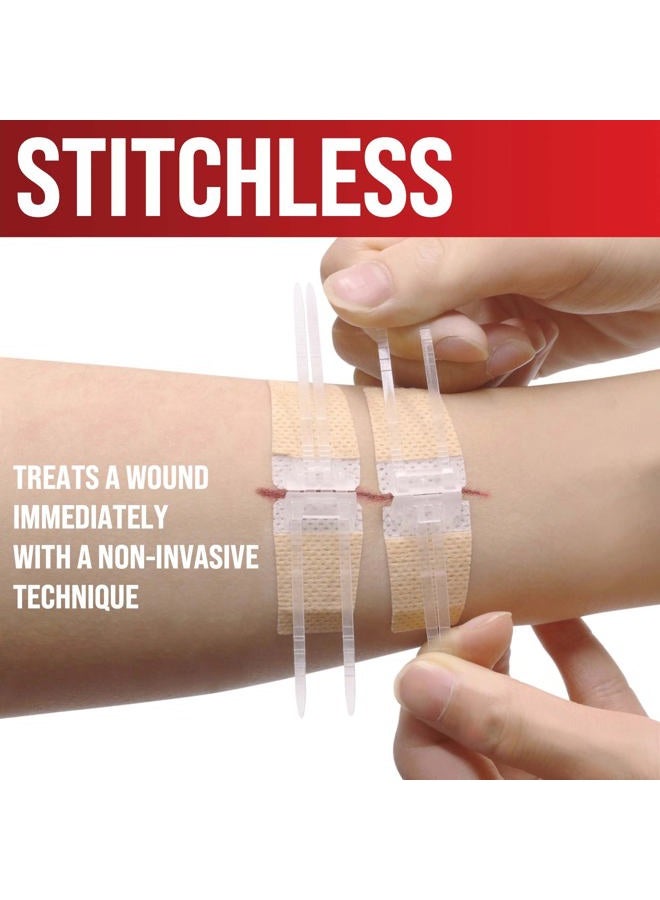 MYHELP Emergency Wound Closure Strips - 4pk - 2 Types Laceration Closure Kit - Stitchless & Easy to Use - Butterfly Bandages - Image 3