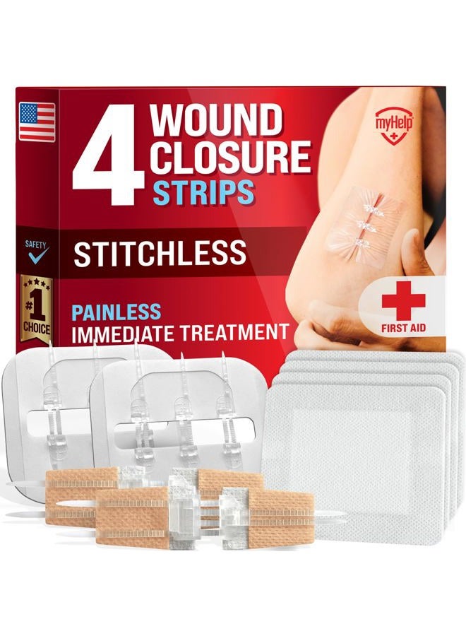 MYHELP Emergency Wound Closure Strips - 4pk - 2 Types Laceration Closure Kit - Stitchless & Easy to Use - Butterfly Bandages - Image 1
