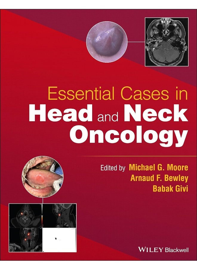 Essential cases in head and neck oncology  - Image 1