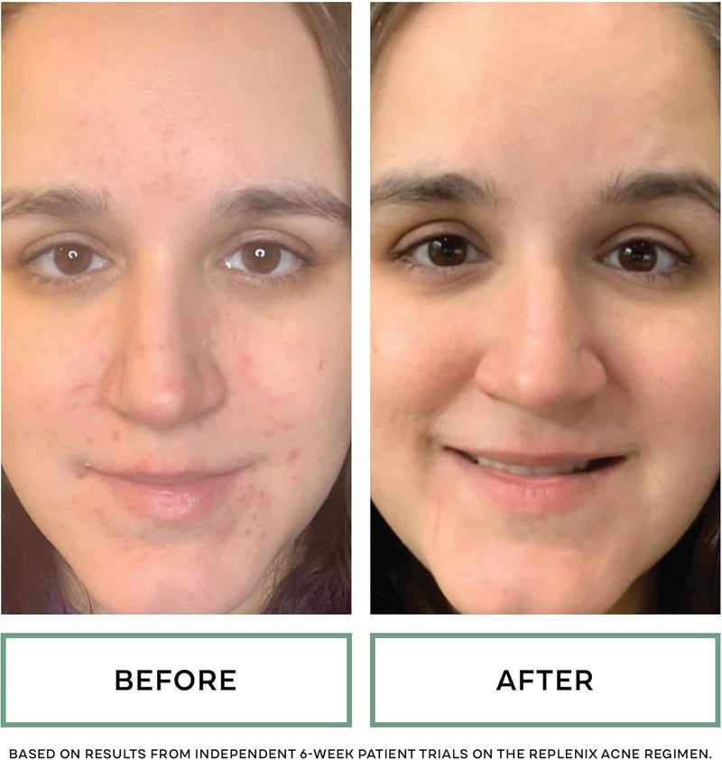 Replenix Green Tea Gentle Soothing Cleanser - Medical-Grade Face Wash for Sensitive Skin (6.7 fl. oz) - Image 4