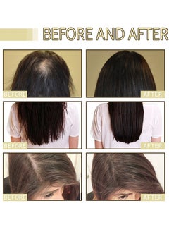 EELHOE Veganic Natural Hair Growth Oil, Anti Hair Loss Natural Hair Growth Oil, Natural Ingredients Dense Hair Essential Oil, Rosemary Oil for Hair Growth Nourishing And Repairing Hair  - Image 4