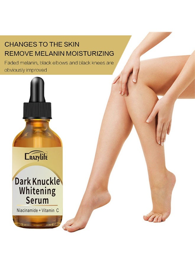 Crazylife Dark Knuckle Whitening Serum, Joint Darkening Serum, Acanthosis Nigricans Oil Dark Spot Corrector, Lighten And Repair Melanin, Skin Brightening Serum, Skin Care Removal Body Bleaching For Knuckle Elbows 30ml - Image 5