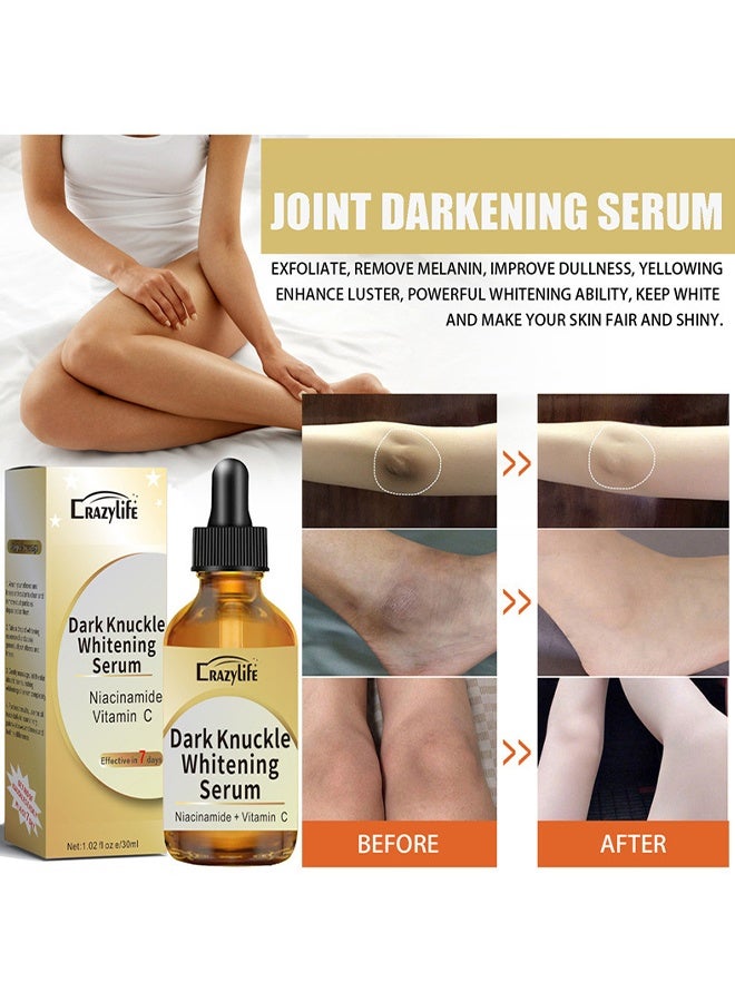 Crazylife Dark Knuckle Whitening Serum, Joint Darkening Serum, Acanthosis Nigricans Oil Dark Spot Corrector, Lighten And Repair Melanin, Skin Brightening Serum, Skin Care Removal Body Bleaching For Knuckle Elbows 30ml - Image 4