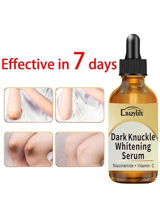 Crazylife Dark Knuckle Whitening Serum, Joint Darkening Serum, Acanthosis Nigricans Oil Dark Spot Corrector, Lighten And Repair Melanin, Skin Brightening Serum, Skin Care Removal Body Bleaching For Knuckle Elbows 30ml - Image 2