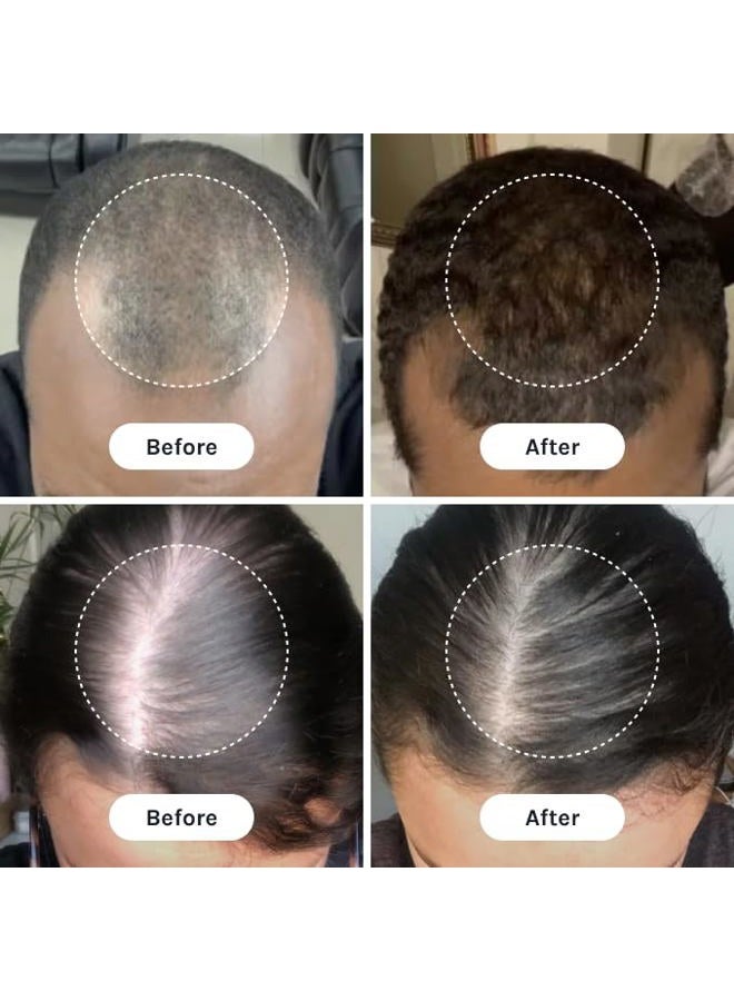 InfiniWell PTD-DBM + Methyl Vanillate Hair Growth Dropper For Visibly Thicker, Stronger Hair - Image 5