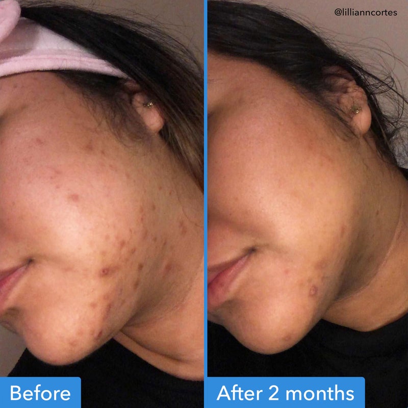 Good Molecules مصل تصحيح تغير اللون من Good Molecules - ملح إستر حمض الترانيكساميك والنياسيناميد للبقع الداكنة وأضرار الشمس والبقع العمرية - العناية بالبشرة والوجه - Image 3