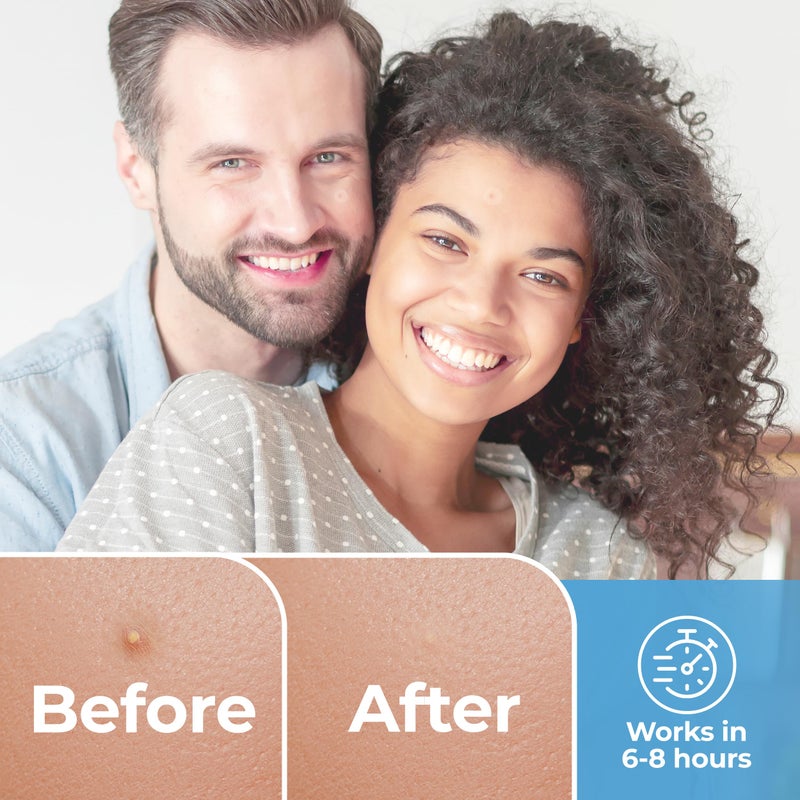 BASIC CONCEPTS Pimple Patches for Face (120 Pack), Hydrocolloid Patch with Tea Tree Oil - Pimple Patch Zit Patch and Pimple Stickers - Hydrocolloid Acne Patches for Face - Zit Patches -Blemish Patches - Image 2