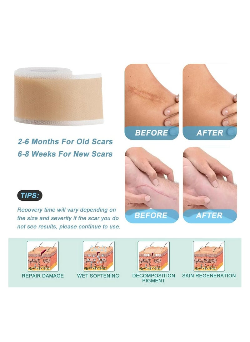 CMGTYYD - 2 Pack Silicone Scar Sheets (1.6”x60” Roll), 2 Roll Medical Grade Washable Silicone Scar Tape, Reusable Scar Removal Sheets for C-Section, Surgery, Burn, Keloid, Acne. - Image 1