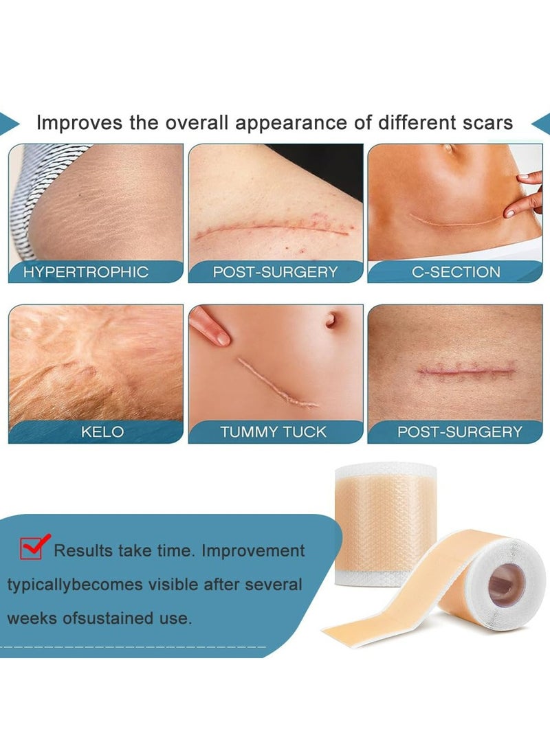 CMGTYYD - 2 Pack Silicone Scar Sheets (1.6”x60” Roll), 2 Roll Medical Grade Washable Silicone Scar Tape, Reusable Scar Removal Sheets for C-Section, Surgery, Burn, Keloid, Acne. - Image 1