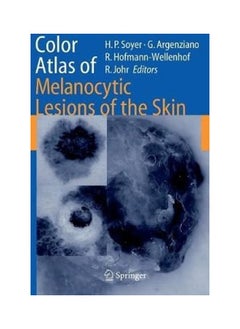 Color Atlas Of Melanocytic Lesions Of The Skin - pzsku/Z0E47CDA5FB0614CCF33CZ/45/_/1738064968/bcab05a9-cab8-4db3-a09e-b64543d9a050