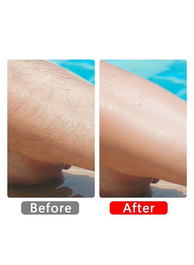 1PCS Kneading Painless Nano Epilator - Image 5