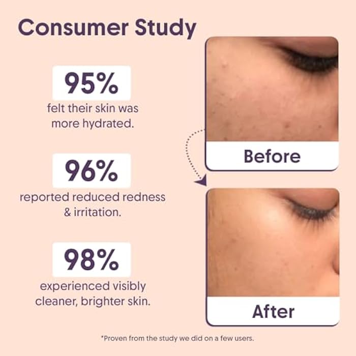 Aravi Organic Barrier Repair Combo | Moisturizer & Cleanser | Restores Skin Barrier, Hydrates & Soothes | pH-Balanced, Non-Comedogenic & Fragrance-Free | For Dry & Sensitive Skin - Image 4