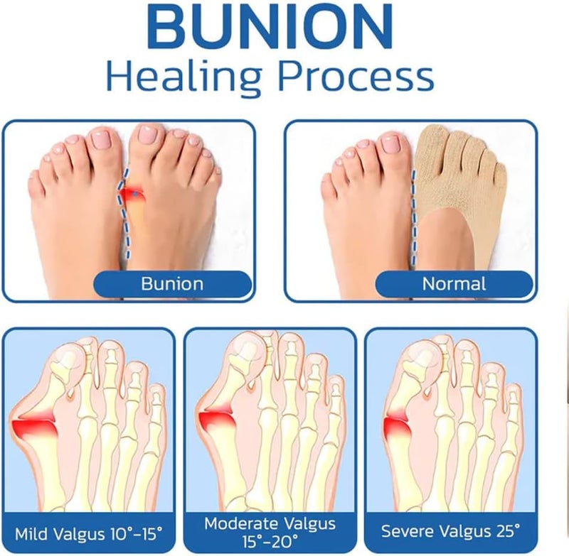 woobles Orthoes Bunion Relief Socks, Sock Align Toe Socks for Bunion, Anti Bunions Socks, Bunion Relief Socks, Split Toe Orthopedic Compression Bunions Socks (5pairs) 5pairs - Image 4