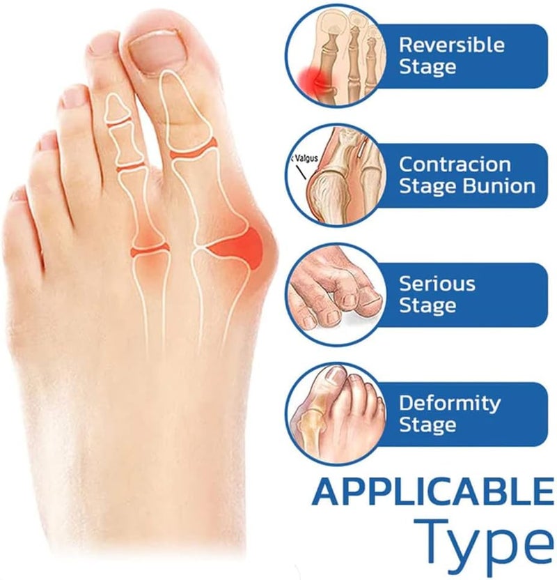 woobles Orthoes Bunion Relief Socks, Sock Align Toe Socks for Bunion, Anti Bunions Socks, Bunion Relief Socks, Split Toe Orthopedic Compression Bunions Socks (5pairs) 5pairs - Image 2