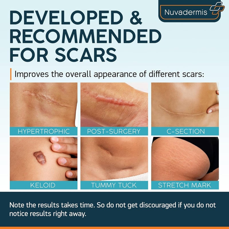 Nuvadermis Scar Tape  Glycolic Pads  CSection Tummy Tuck Keloid Removal Treatment  Post Surgery Supplies  Patch Bandage  Exfoliating Facial Peel  Radiance Face Wipes  60 DoubleSide Pads - Image 2