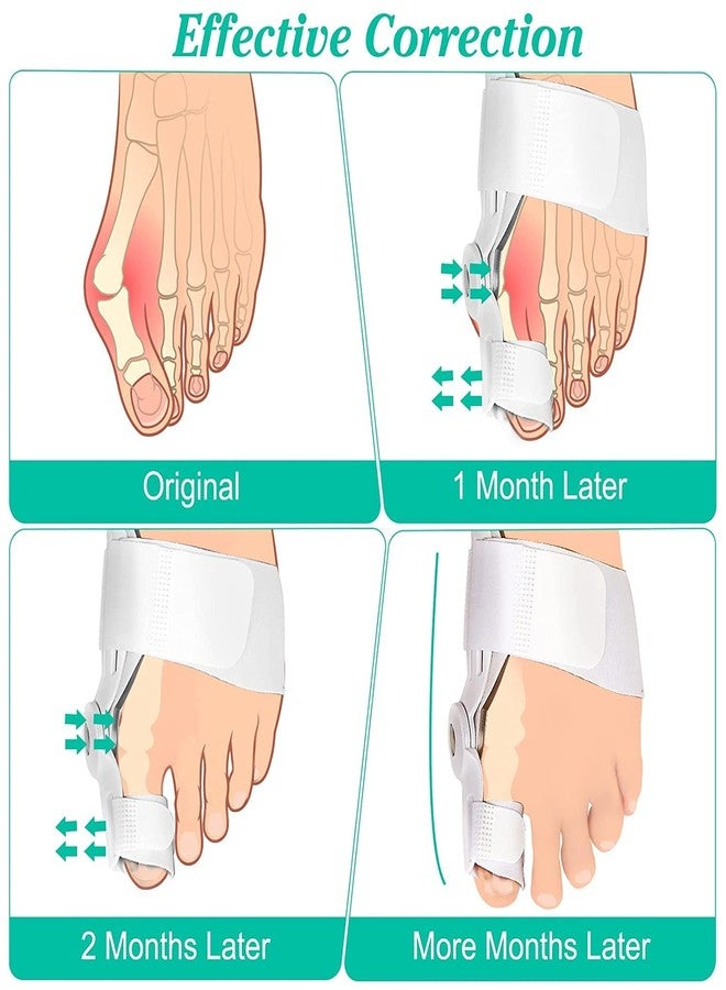 QualiTrue Silicone Bunion Corrector For Women Men, Orthopedic Toe Separator Bunion Splint With Fracture Support And Pain Relief, Adjustable Design For Right/Left Foot Alignment (1 Splint, 1 Separator) - Image 5